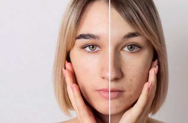 10 Tips Merawat Kulit Dengan Cara Alami hingga Pakai Skincare