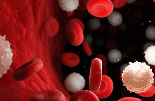 Berbagai Cara Pencegahan Leukemia Yang Perlu Diterapkan Sejak Dini