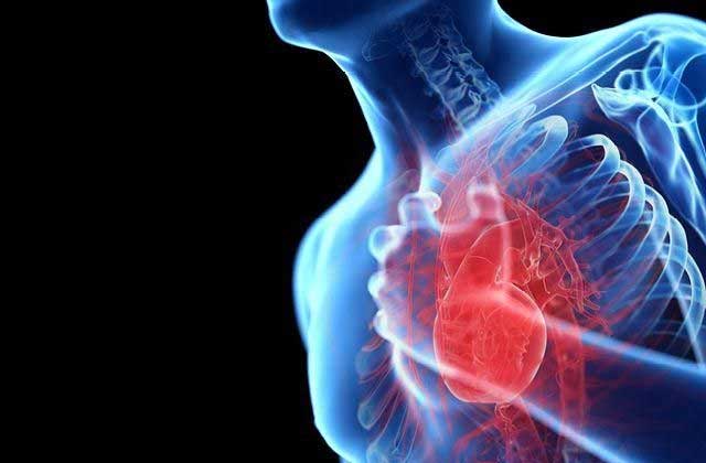 Penyebab Jantung Koroner Yang Perlu Diwaspadai